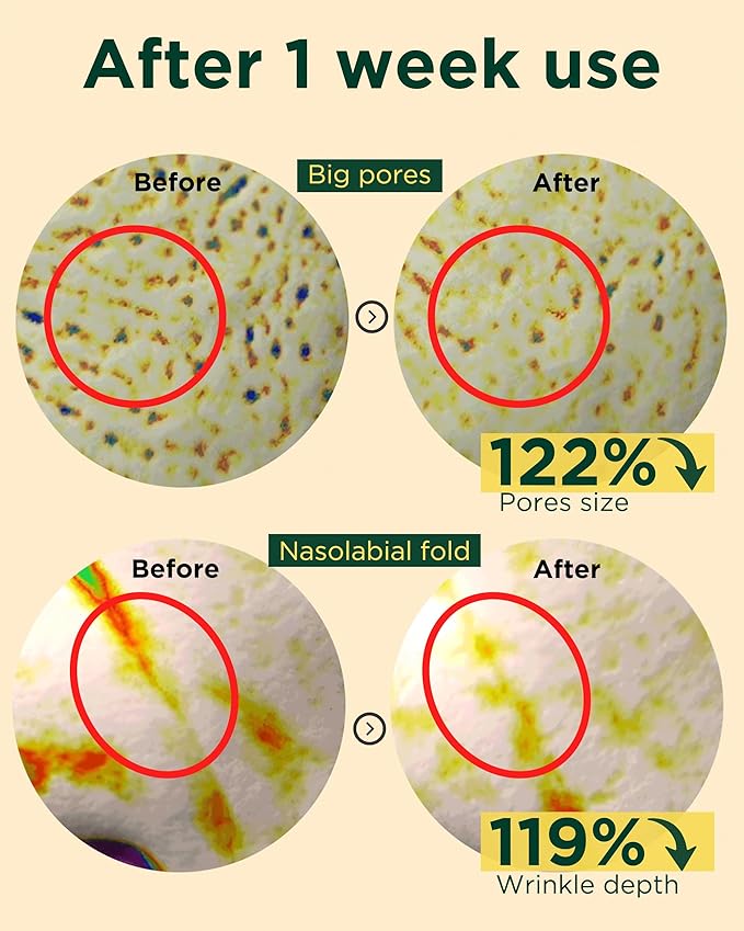 EASYDEW DW-EGF Peptide Retinol 0.03% Cream – Beginner Retinol Night Cream for Hypoallergenic Skin Care - Firm Skin, Wrinkle Improvement - Korean Daily Anti Aging Face & Neck Treatment, 1.01fl. oz.