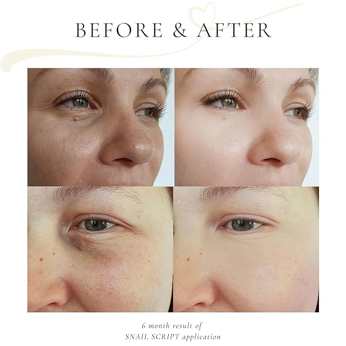 Snail Script Eye Cream, Snail Mucin Black Snail Repair lotion for Face Korean SkinCare Snail Moisturizer Hyaluronic Acid Vitamin C for face, Collagen Eye Cream Corrector