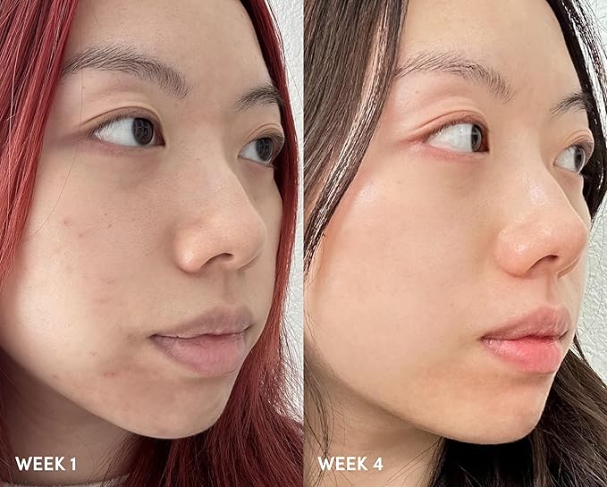 Goodal Apple Mint AHA BHA Exfoliating Serum, 2.5% AHA, 0.5% BHA Salicylic Acid for Blackheads Enlarged Pores Wrinkles and Fine Lines Face Exfoliators, 18 Free Formula, 1.69 fl. oz.