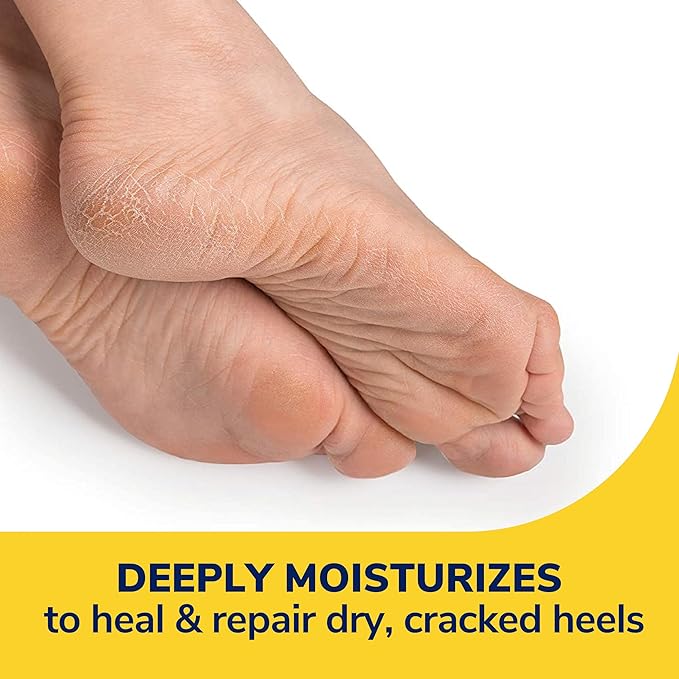 Dr. Scholl's Severe Cracked Heel Repair Restoring Balm 2.5oz, with 25% Urea for Dry, Cracked Feet, Heals and Moisturizes for Healthy Feet, Epsom Salt Soothes, Safe for Diabetics, 3-pack