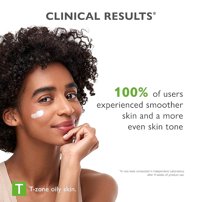 SEBO-ALMOND PEEL Dermo Exfoliating Night Cream with 5% Mandelic Acid, Face Moisturizer, Helps Reduce the Visibility of Imperfections, Blemishes and Shine, Evens Skin Tone, 1.69 fl. oz