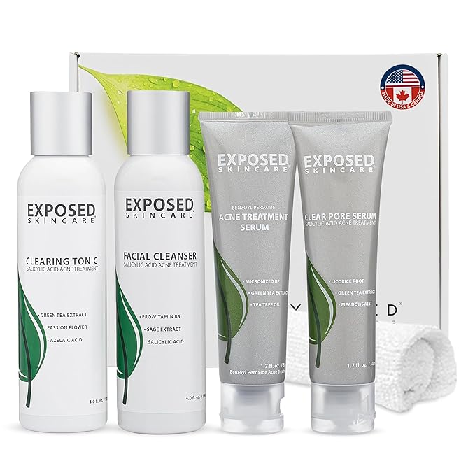 Exposed Skin Care Basic Acne Treatment Kit - Includes Salicylic Acid Face Wash, Clearing Tonic, Acne Treatment Serum with Benzoyl Peroxide, Clear Pore Serum - Acne Set Solution for All Skin Types
