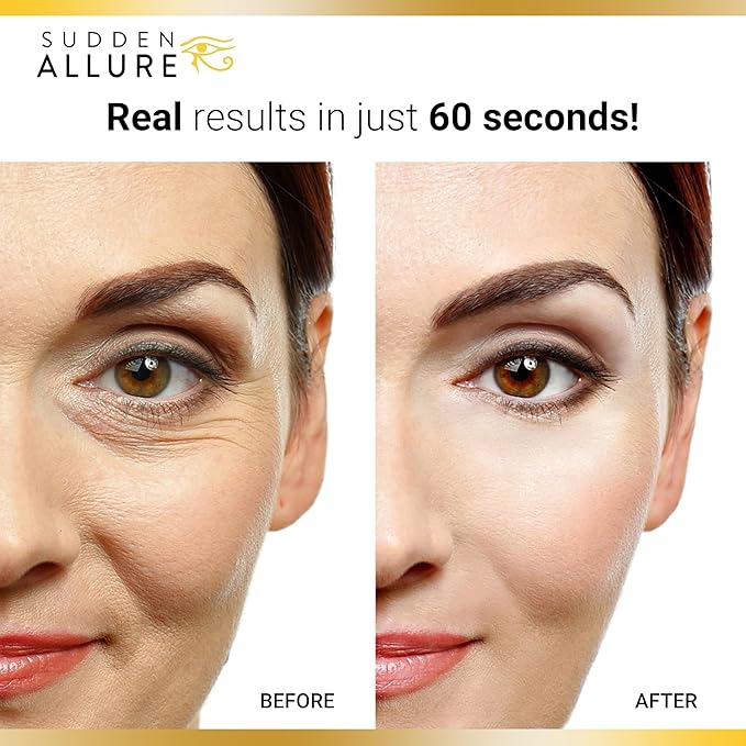Sudden Allure Instant Under Eye Treatment Serum – Erase Under Eye Bags, Dark Circles, Wrinkles & Lift Sagging Eyes - Instantly Tighten & Firm - Reduce Eye Bags & Crows Feet | Made in USA (10 ml, 3pk)