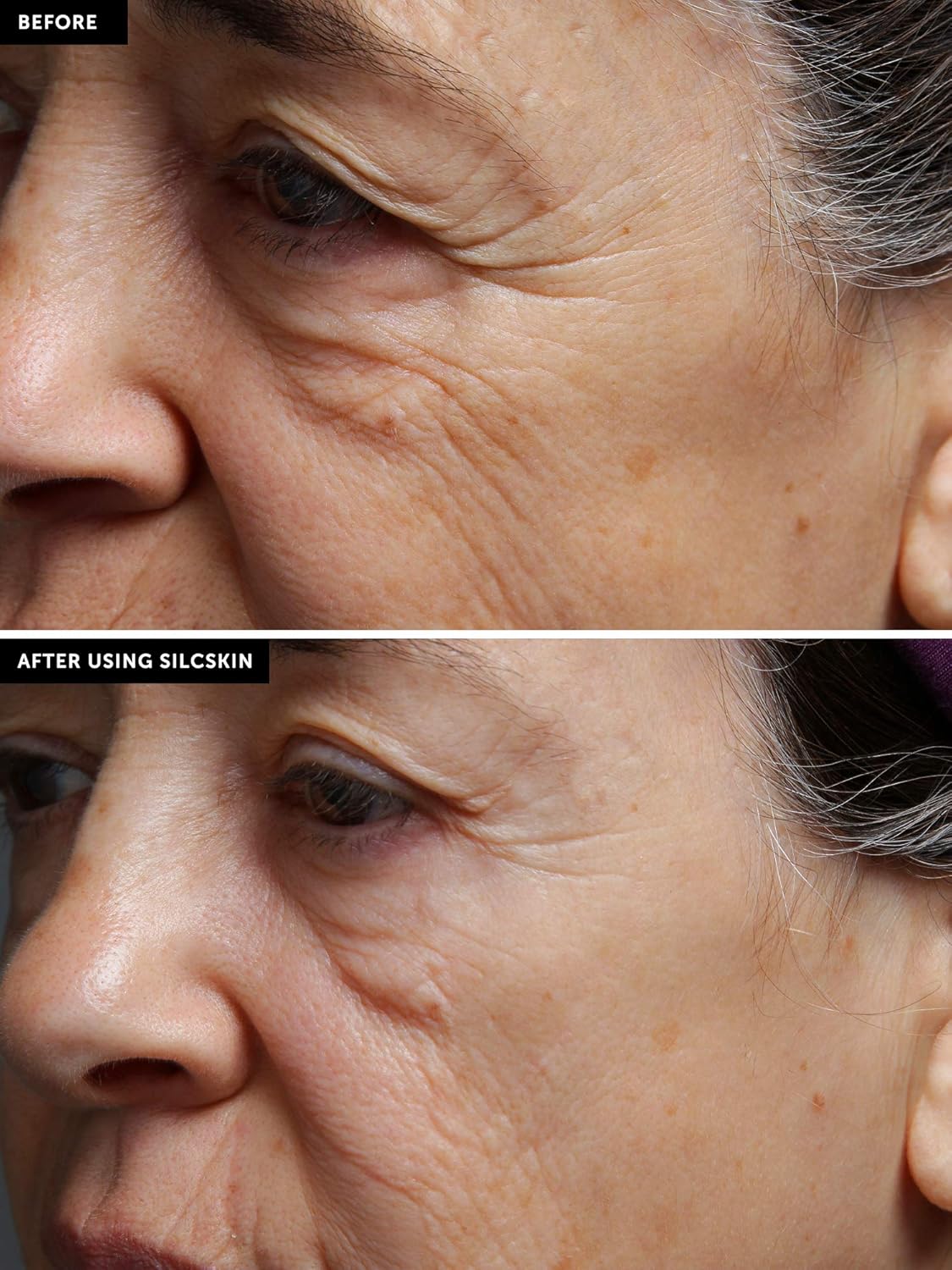 SilcSkin Full Face Set, Helps with Face & Brow Wrinkles from Sun Aging Side Sleeping, Reusable Self Adhesive Medical Grade Silicone, 1 Brow Pad, 4 Eye Pads, 2 Multi-Area Pads - 45 Day Supply