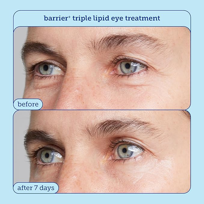 Skinfix Barrier + Firm Trio - Full-Size Plumping Serum, Mini Moisturizer, Mini Eye Cream with Patented B-L3™ Complex - Hydrate & Strengthen Skin Barrier