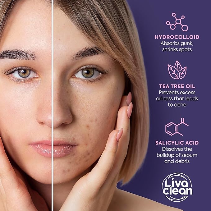 LivaClean Star Pimple Patches for Face w/Hydrocolloid, Salicylic Acid & Tea Tree, 240 Patches, Hydrocolloid Acne Patch, Cute Star Pimple Patch for Healing Stickers Zit Superstar