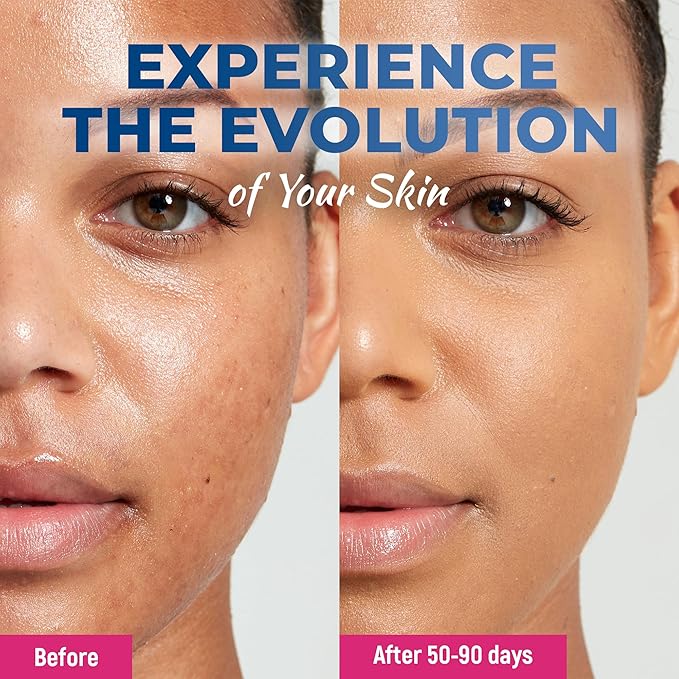 Niacinamide Face Serum – Vitamin B3, Hyaluronic Acid & Panthenol – Hydrating, Improves Skin Radiance, Refines Skin Texture – Skin Care - Hyaluronic Acid Serum– 30ml