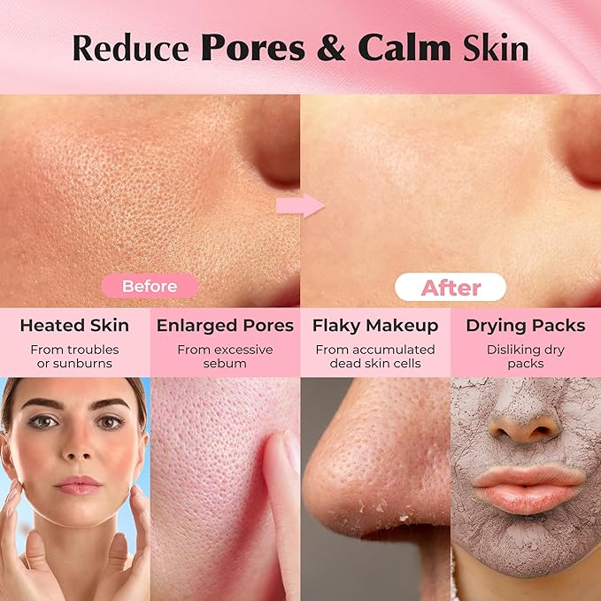 Aperire Pore Clay Mask Very Pretty Calamine Deep Clean, Sensitive Skin Oily Acne 4.2 oz