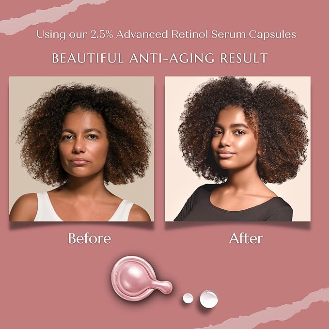 Turbinne Pure 2.5% Retinol Serum Capsules. Look 5 Years Younger In 30 Days. Powerful Anti -Aging, Deep Hydration, Brightening, Reduce Acne, Dark Spots & Wrinkles (30 Count)