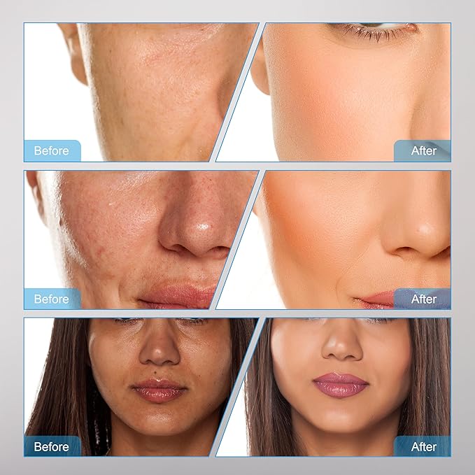 Eltizia Electroporation Machine Skin Care Tool Solution Importer Skin Management Hot And Cold Promotes Absorption ETLB365