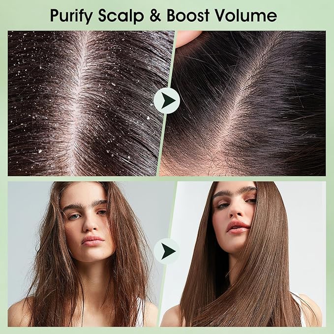 Scalp Scrub, Tea Tree Scalp Exfoliator Scrub Shampoo, 2-in-1 Scalp Treatment with Mint Oil, Hair Treatment to Clarify and Remove Build up with Silicone Scalp Massager, 10.6oz/300g