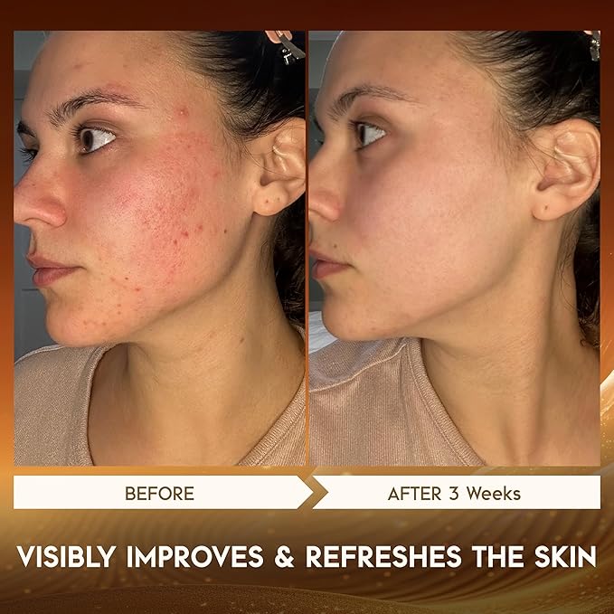 KINGDO 7-Colors LED Face Mask with Automatic Foaming Face Scrubber