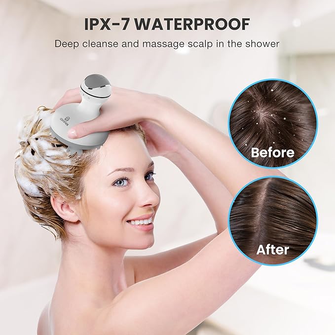 COMFIER Cordless Scalp Massager Hair Growth,Electric Head Massager Scalp Stress Relax with 8 Massage Claws,Waterproof Hair Massager Scalp,Cat Massager,Gifts for Him Her