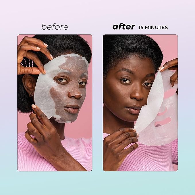 Vitamasques Vitamin C Cherry Face Sheet Mask 7 Pack - Brightens, Protects & Boosts Hydration with Antioxidants, Vitamin C and Ferulic Acid - Natural - Vegan - Korean Skin Care