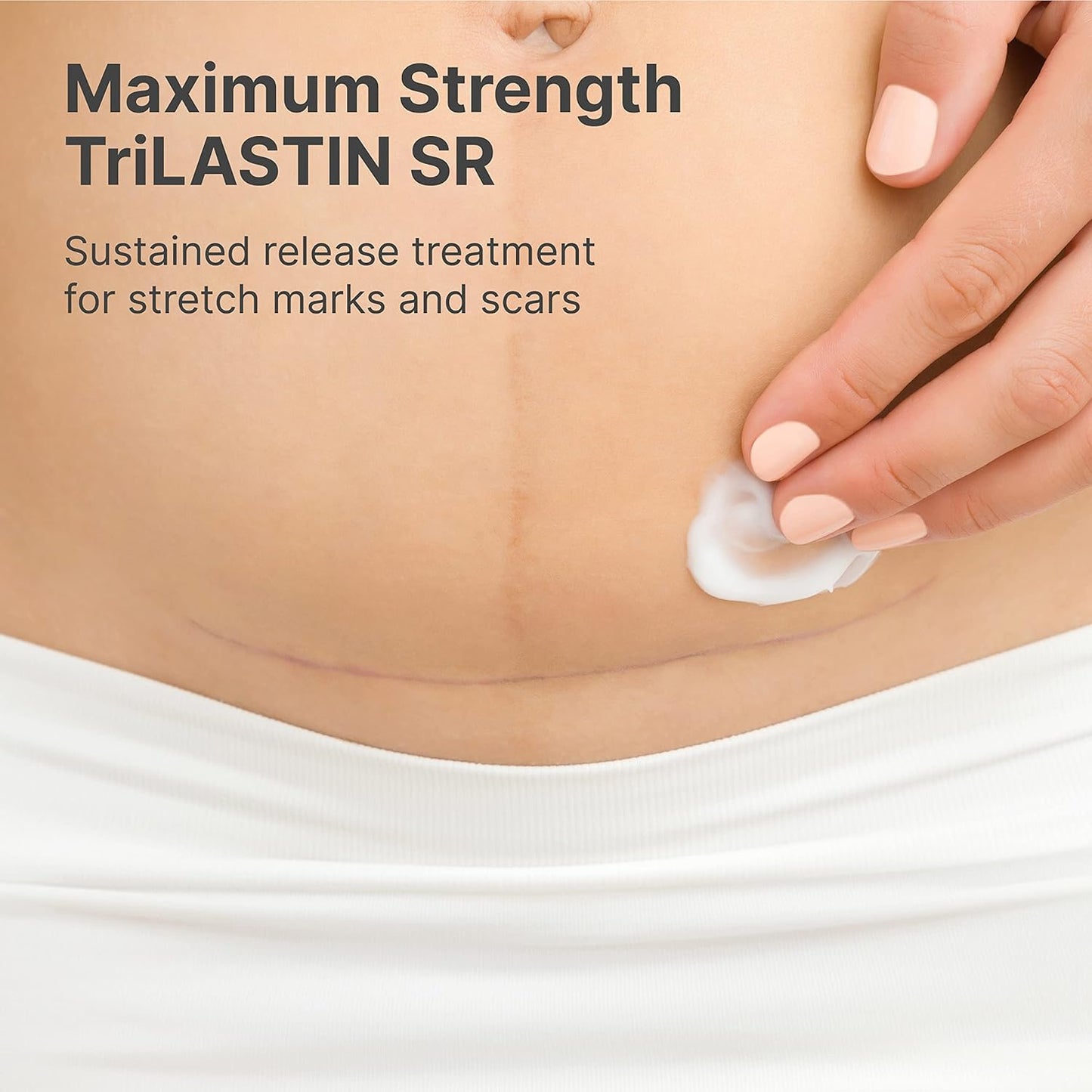 TriLASTIN-SR Intensive Stretch Mark Cream (5.5oz) Bundle with Nipple & Lip Balm (3pk) | Fast-Acting Stretch Marks Cream with Absorption Enhancing Serum | Breastfeeding & Ingesting Safe Balm