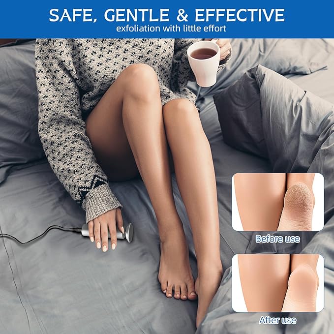 Dermave Electric Foot Callus Remover, Electric Foot Callus Remover, Callus Remover for Feet - Foot Filer with 60pcs Sanding Discs for Dead Cracked Skin, Men/Women (Silver)