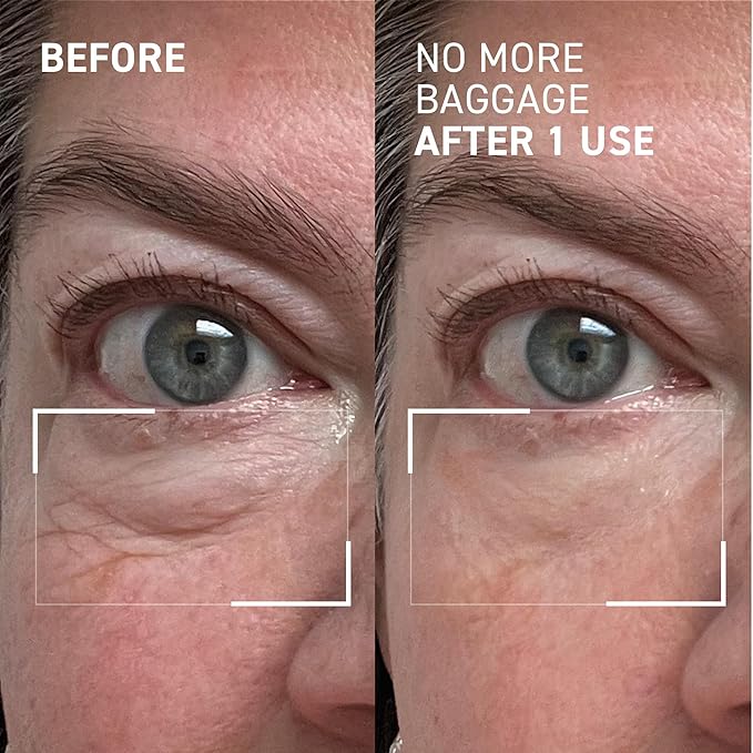 Dr. Brandt Needles No More, No More Baggage - Minimizes Under-Eye Bags, Puffiness & Dark Circles - 0.5 oz