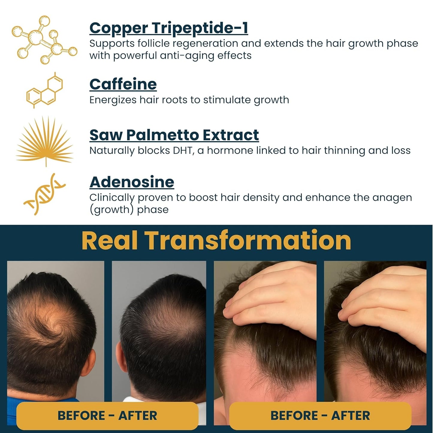 Copper Peptide Serum for Hair Growth - Caffeine, Niacinamide, Rosemary Oil, Saw Palmetto Hair Density Serum, Topical Tripeptide Scalp Care for Hair Thinning, Women & Men 1 fl oz