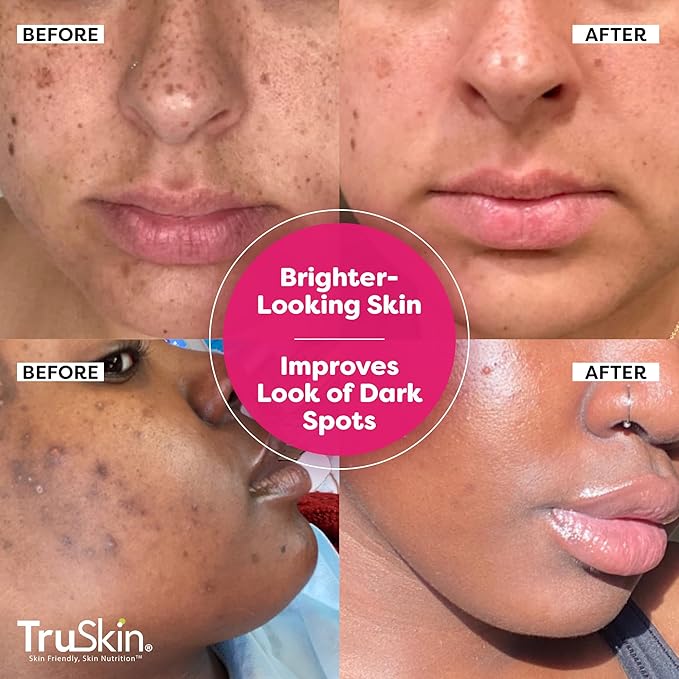 TruSkin Vitamin C Super Serum - Niacinamide, Retinol, Hyaluronic & Salicylic Acid - All-in-One Anti Aging Serum for Face – Improve Appearance of Dark Spots, Firmness for Brighter Looking Skin, 1 Fl Oz