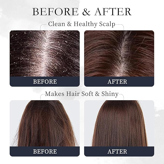 Pure Natural Organic Rosemary Essential Oil, Treats Hair Care Scalp Growth Loss Keratin Collagen Argan Tea Tree Oil Lightweight