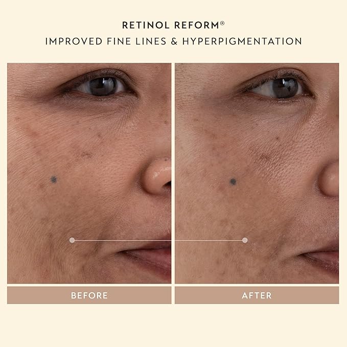 SHANI DARDEN SKIN CARE Sculpt & Firm Travel Kit, Facial Sculpting Wand, Attachments, Retinol Reform & Lactic Serums, Peptide Cream & Pep Gel, 7 Items