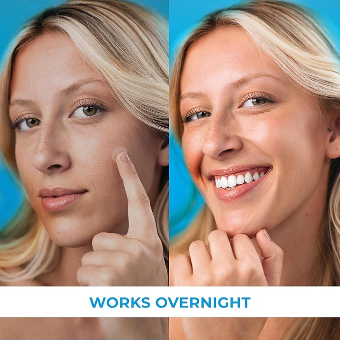 PatchRx Pimple Patches for Face (120 Patches), Hydrocolloid Acne Patches with Tea Tree Oil, Pimple Patch Pimple Stickers - Hydrocolloid Patch Acne Dots - Acne Pimple Patches For Face - Zit Patches