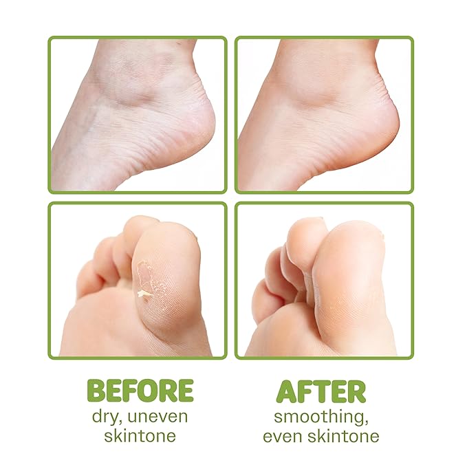 ONSOI 12PK Foot Masks for Soft, Smooth, Moisturizing Foot Mask for Dry Cracked Feet, Baby Feet - Coconut & Shea Butter (12PK Shea Butter)