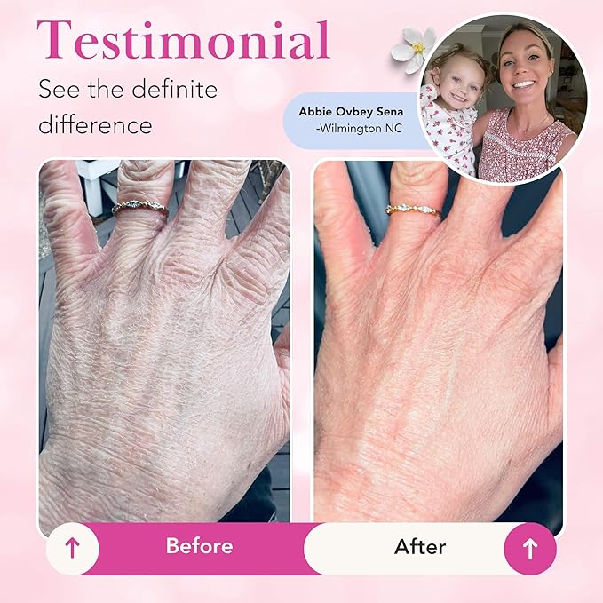 Theraplex Clear Lotion Spray (8 oz) - Natural Jojoba Oil, No Parabens or Preservatives, Noncomedogenic and Hypoallergenic, Dermatologist recommended - National Eczema Association Seal of Acceptance