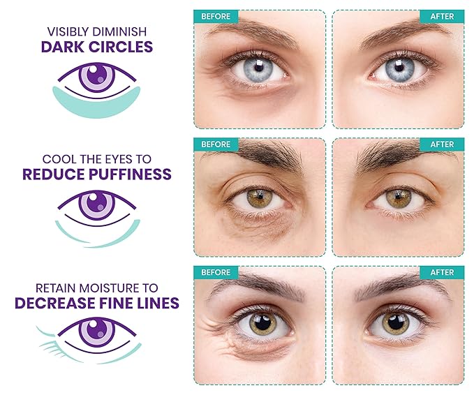 Stylia Under Eye Patches for Puffy Eyes and Dark Circles (6 Pairs) - Marine Collagen Under Eye Mask with Retinol, Vitamin C, Hyaluronic Acid, Pearl Extract - Eye Masks for Dark Circles and Puffiness