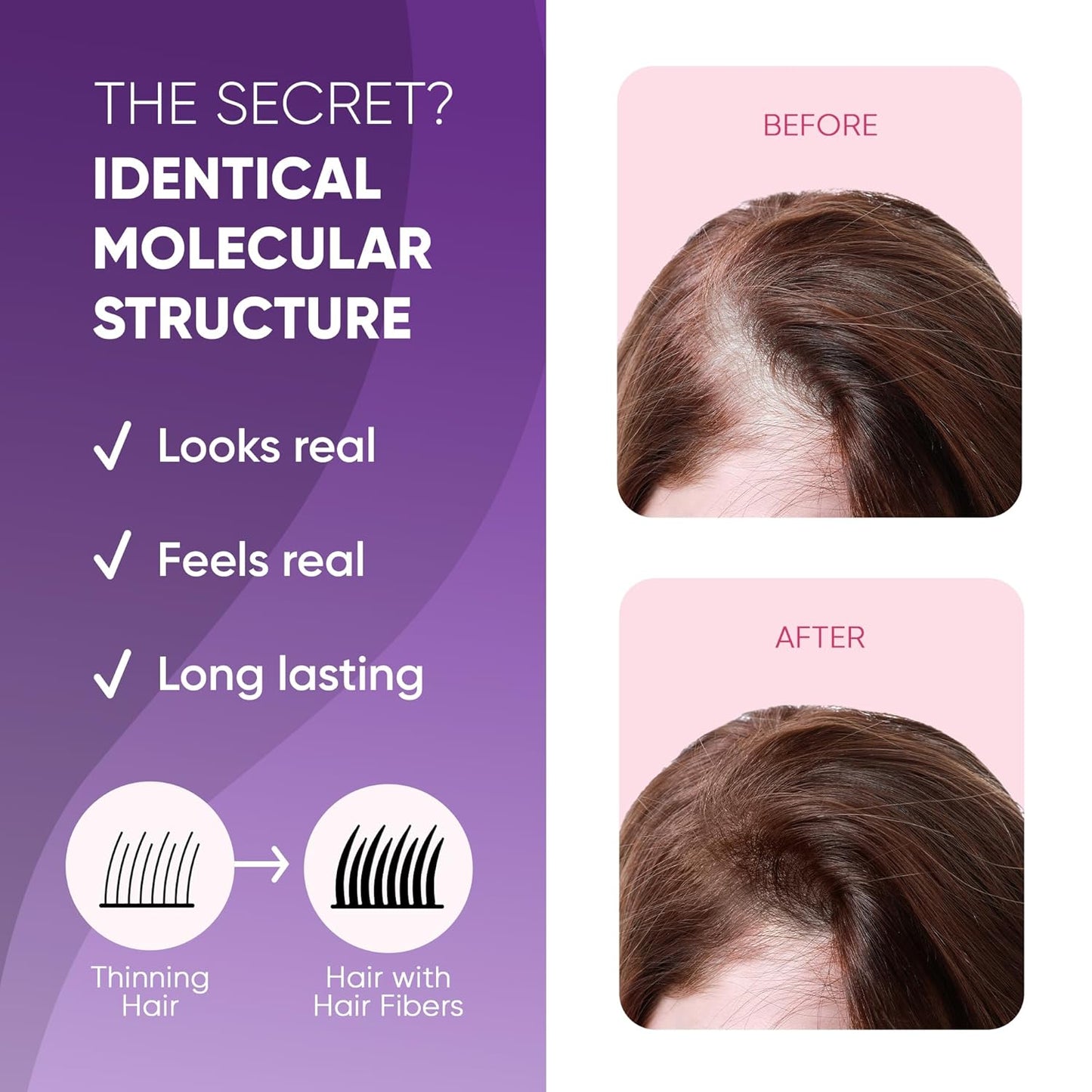 GBG Hair Fibers for Thinning Hair & Bald Spots (Dark Brown) - 25g Bottle - Conceals Hair Loss - Instant Cover Up & Volume in 30 Seconds, Hair Powder for Women & Men - Cruelty Free