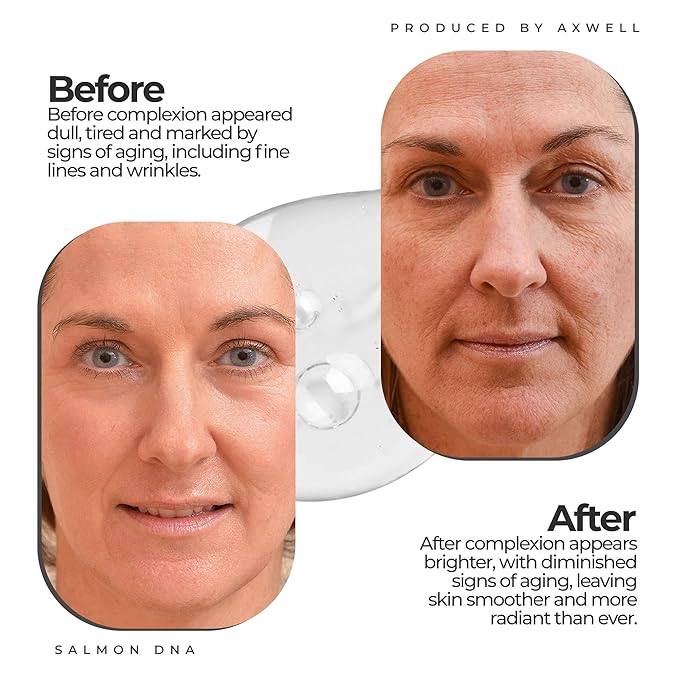 AXWELL Professional Anti Aging Serum for Face with Salmon DNA+, Skin Care Booster, Youthful Skin Repair Serum, Plumps Softens and Brighten Skin for Women & Men for All Skin Type (1.01 fl. oz, 30ml)