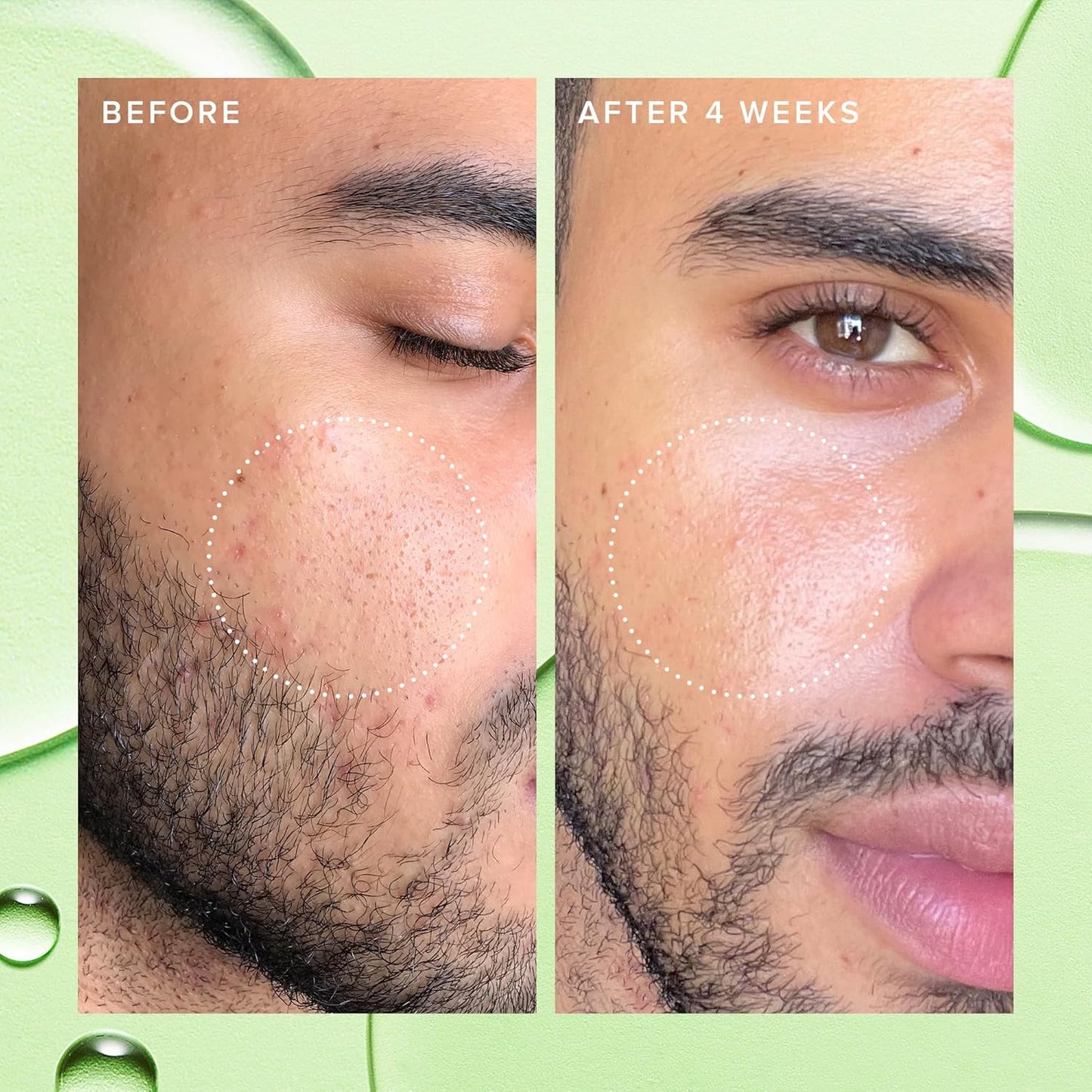 Farmacy 2% Salicylic Acid Toner for Face - Deep Sweep Gentle BHA Exfoliant for Oily Skin - Refines Texture with Papaya Enzymes & Moringa Water for a Healthy-Looking Complexion (100ml)