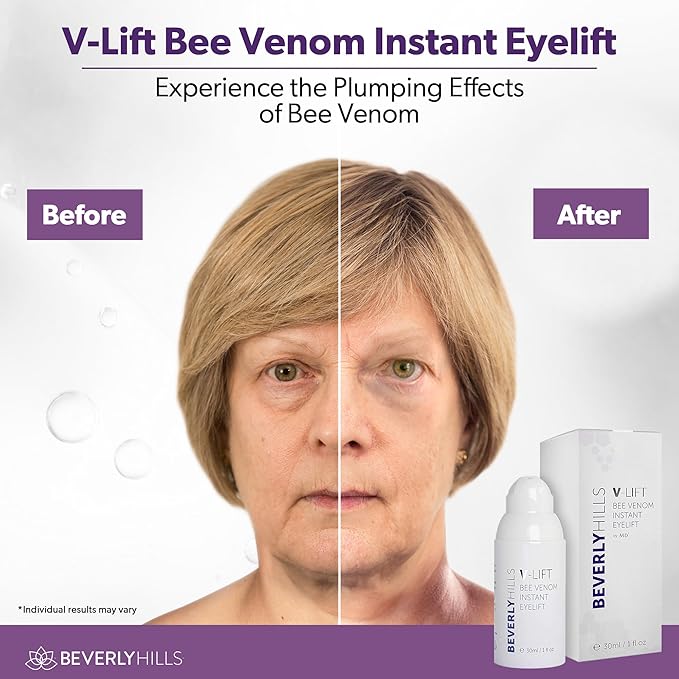 Beverly Hills V-lift Instant Eye Lift & Instant Facelift Anti Aging Eye Serum Treatment Bundle with Discount - Serum Treatment for Dark Circles, Wrinkles & Under Eyebags for Women & Men