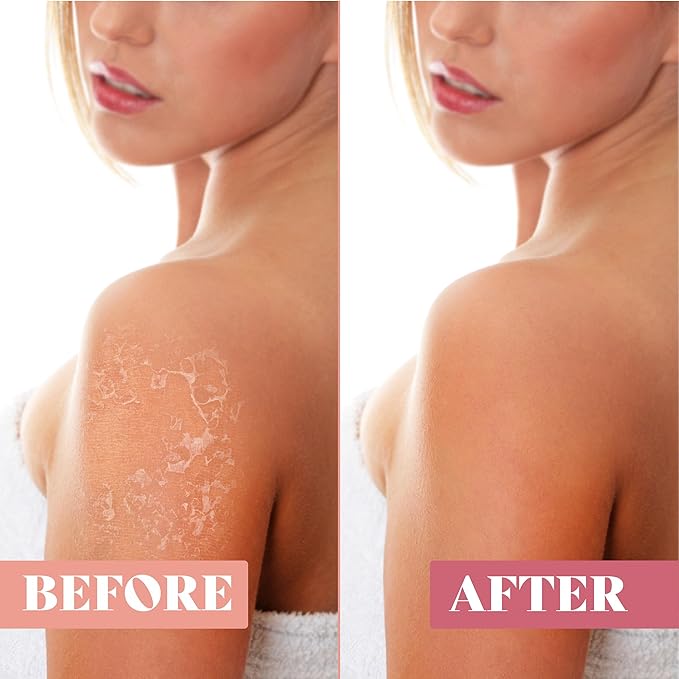 Exfoliating Mitt (3 PCS) - Kessa Exfoliating Glove, Turkish Hammam Body Scrub, Exfoliator Dead & Dry Skin Cell Remover Buffing Treatment - Great for Spray Tan Removal, Smooth Skin Surface