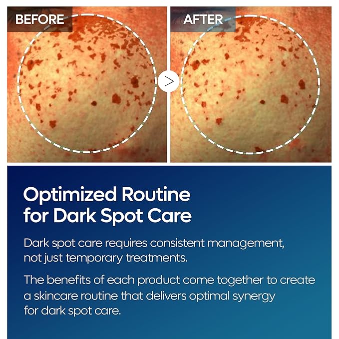 TX Tranexamic Acid Care Line TX cream+Toner+Ampoule+Cleanser Powerful Dark Spot Care | Visible Improvement in 4-8 Weeks