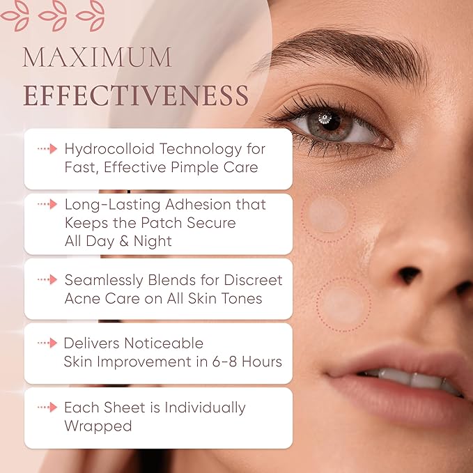 Prime Patch - Hydrocolloid Pimple Patches for Face, Clear Zit Stickers & Acne Dots, Strong Adhesion, Ultimate Blemish & Acne Patch, Made in Korea, Vegan (75 Count)