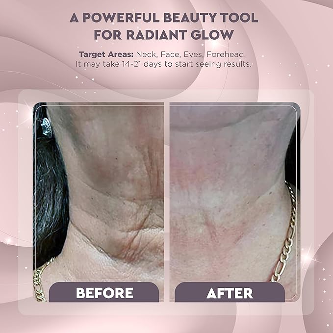GLO24K Red Light Beauty Device for Face and Neck. Based on Triple Action L E D, Thermal, and Vibration Technologies.