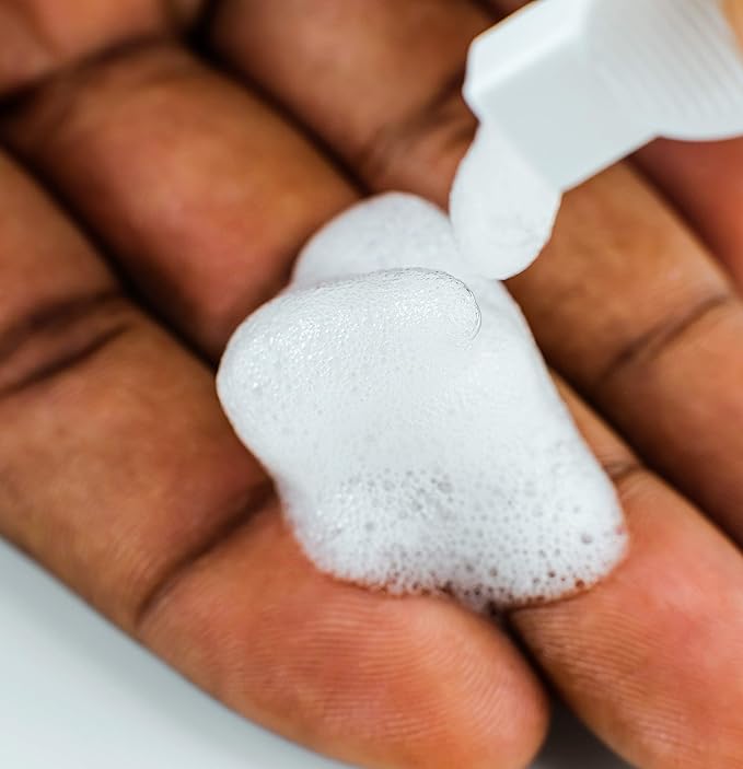 ScalpBliss Soothing Scalp-Purifying Foam Treatment to Clear Flakes, Product Build Up, and Soothe Scalp Irritation,