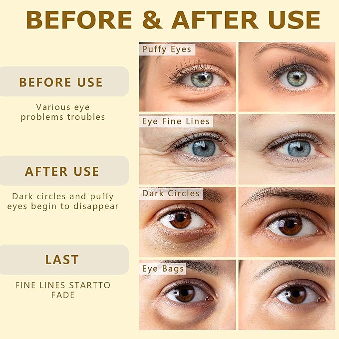 COSMETIC |24k Gold Vitality-Fill Hydra-Gel Eye Patches(30 Pairs) | Help Boosting Lift & Firm the Look of the Eye Area, Anti-Aging Under-Eye Patches