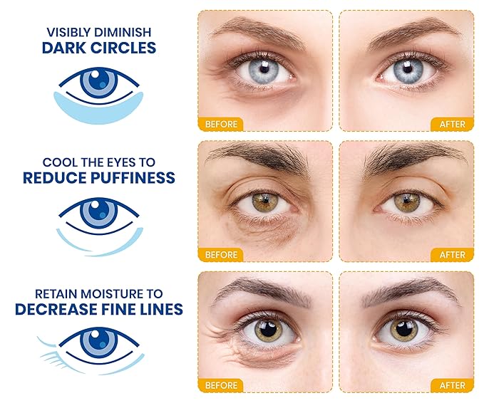 Stylia Under Eye Patches for Puffy Eyes and Dark Circles (30 Pairs) - 24k Gold Under Eye Mask with Vitamin C, Hyaluronic Acid, Pearl Extract - Eye Masks for Dark Circles and Puffiness