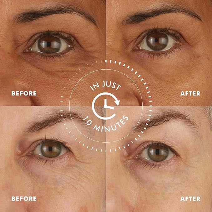 skyn ICELAND Hydro Cool Firming Under Eye Patches with Peptides and Coenzyme Q10 Instant Cooling Relief for Tired Puffy Eyes, 16 Pairs