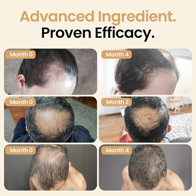 Hair Booster for Women & Men – Hair Revitalizing Serum with Capilia Longa & Arginine for Thick, Dry, Long, Damaged Hair – Peptide-Enriched Hair Tonic, 2 Fl Oz