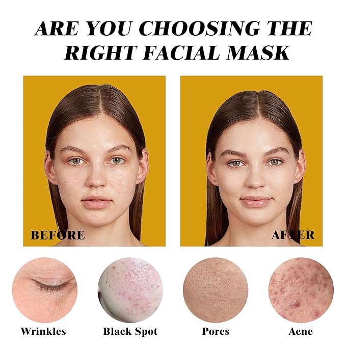 Clay Mask Set (10 Pods) Gold Eye Patches (20 Pairs), Mud Mask Deep Pore Cleansing Acne Blackhead Removal, Eye Patches for Puffy Eyes Dark Circles, Men & Women Facial Mask Eye Masks Skin Care.