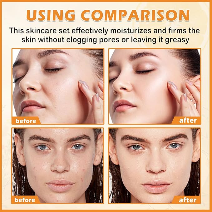 Vitamin C Skincare Set for Teenage Girls 5 In 1 Hydration Facial Skincare Gift Set with Cleanser,Toner,Face Serum,Eye Cream,Face Cream,Travel Size Skin Care Products Set for Women