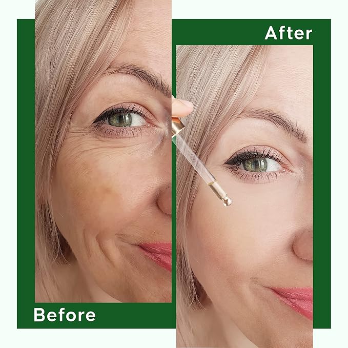 VAUDA 100% Squalane Oil for Face with Vitamin C and Rose Oil – 30 ML Anti-Aging and Hydrating Face Oils for Women, Brightens Skin & Reduces Dark Spots – Plant-Based Natural Squalane Moisturizer Oil