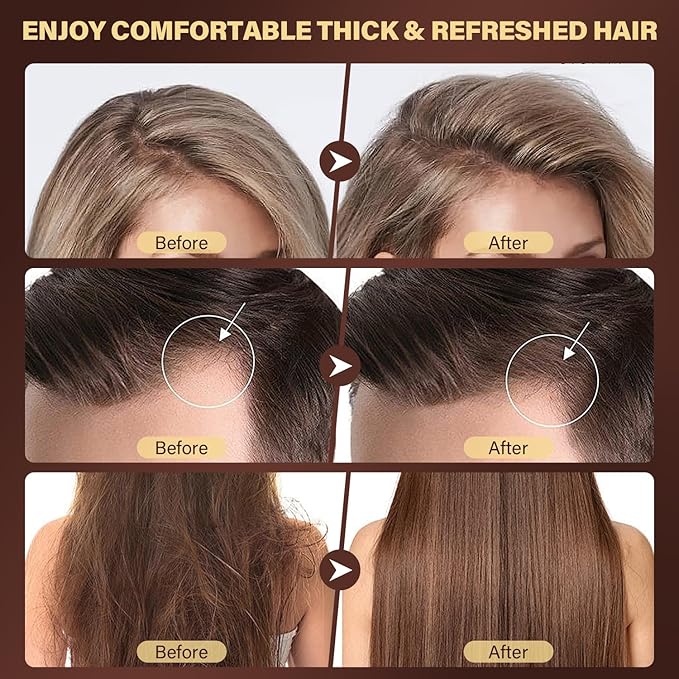 Scalp Scrub for Hair Growth, 2-in-1 Shampoo Scalp Exfoliator with Batana Oil, Rosemary, Mint Oil Remove Dandruff, Hair Treatment with Scalp Scrubber, Thinning Hair & Itchy Scalp Treatment, 10.93 oz