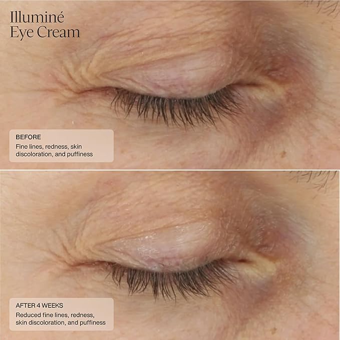 Senté Illuminé Eye Cream | Diminish Dark Circles, Discoloration, Redness, and Puffiness Around The Eyes | with Patented HSA, Niacinamide and Peptides | 0.5 Oz