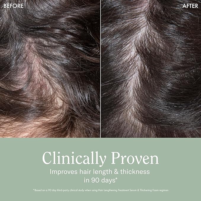 Rizos Curls Hair Lengthening Treatment Serum, Fortifies At Root for Healthy Scalp Microbiome Promoting Length, Supportes Longer Stronger Hair, 4.2 oz