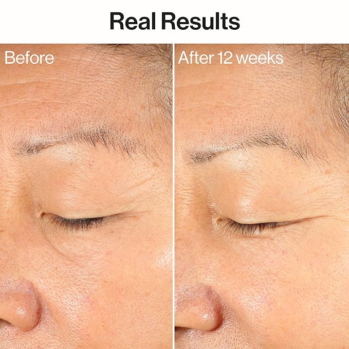 Honest Beauty Ageless Firm and Even Serum | Powered by Vegan Collagen and Elastin Polypeptides | Firmer-Looking Skin and Even Tone | Fragrance Free, EWG Verified, Vegan, Cruelty-Free | 1 fl oz