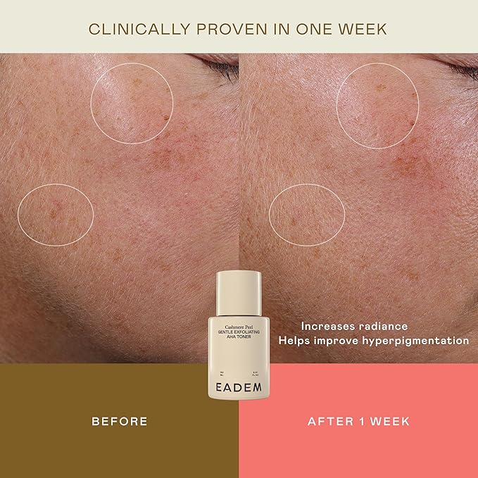 EADEM Gentle Exfoliating AHA & PHA Toner, Exfoliating Face Serum with Tranexamic Acid, AHA Exfoliant & Pore Minimizer for Face and Body, Acne Spot Serum, Mothers Day Gifts, 5.0 oz, Cashmere Peel